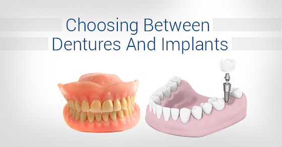 dentures or dental implants