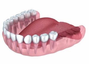 implants in royal oak